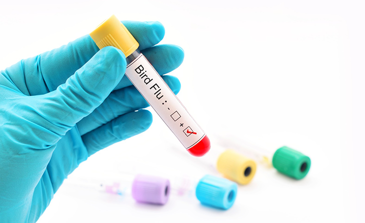 Avian İnfluenza (Kuş Gribi)